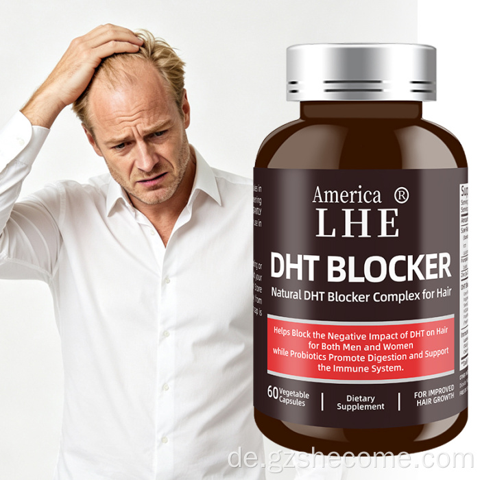 Shecome DHT-Blocker-Kapseln unterstützen das Haarwachstum
